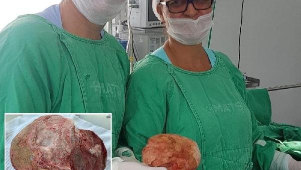 BAHIA: CIRURGIA REMOVE PEDRA DE 1,3KG E 18 CM DA BEXIGA DE UM LAVRADOR